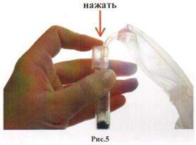 Раствор, образующийся в результате смешивания 2-х компонентов, превращается в белую эластичную массу, плотно прилипающую к тканям. двухкомпонентная система фибринтромбинового клея.
