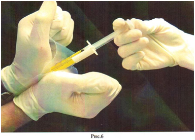 сестре не приходится вручную смешивать порошки: необходимые компоненты уже закачаны в двойные шприцы — хирургу остается лишь надеть смеситель. Устройство предназначено для приготовления 2-х компонентного фибринтромбинового клея